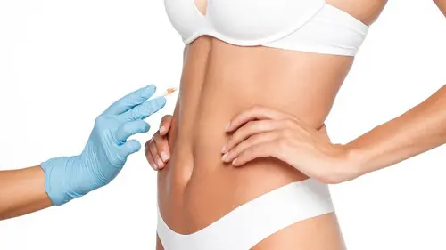 plastiikkakirurgia verhojen jälkeen